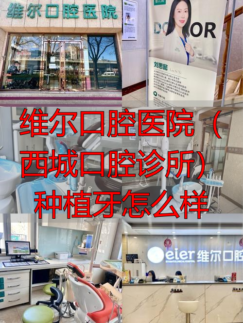 维尔口腔医院(西城口腔诊所)种植牙怎么样_北京维尔口腔_维尔口腔医院