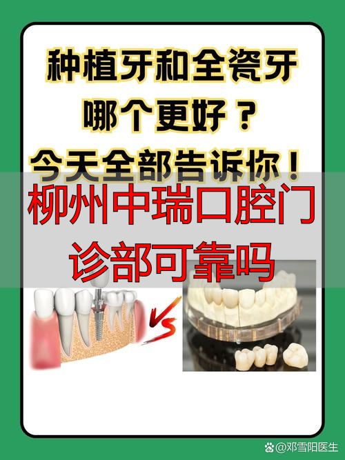 柳州中瑞口腔门诊部可靠吗_柳州中瑞口腔种植牙齿_柳州华喜口腔种植优势