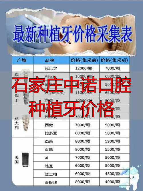 石家庄中诺口腔种植牙价格_石家庄种植牙好的口腔医院_石家庄中诺口腔医院种植牙价格