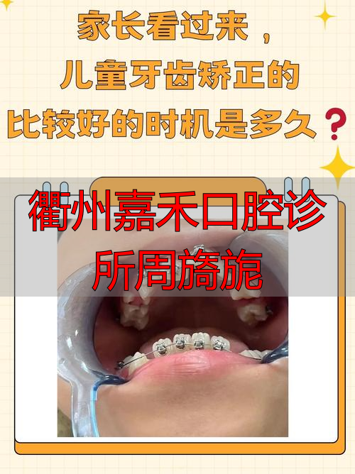 衢州市口腔诊所_衢州嘉禾口腔诊所周旖旎_口腔连锁诊所