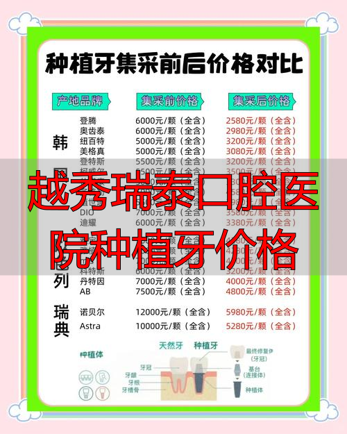 越秀瑞泰口腔医院种植牙价格_瑞泰口腔种牙_口腔医院种植牙价钱