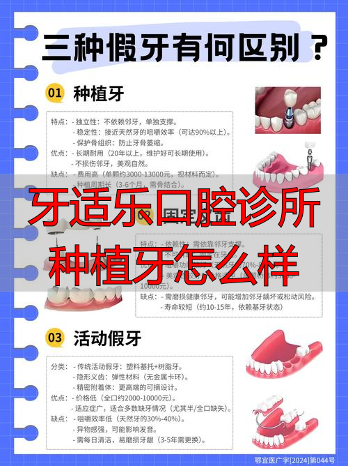 口腔诊所种植要求_口腔诊所种植室装修效果图_牙适乐口腔诊所种植牙怎么样