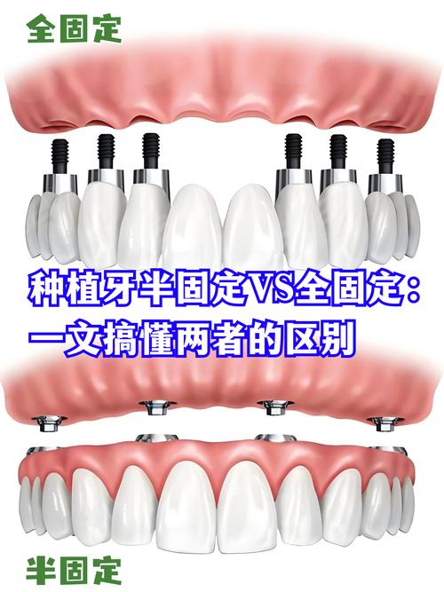 温州蓝芽口腔门诊部假牙价格_温州牙齿种植价格能选蓝芽口腔_温州牙齿矫正价格领先蓝芽口腔