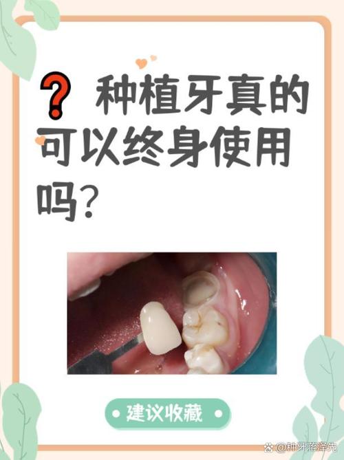 2025年末盘点：上海维乐口腔金文哲医生种植牙真实优缺点评价，哪个好？