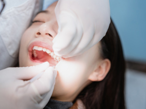 武汉优益佳口腔口碑怎么样？价格贵不贵？种植牙矫正牙修复牙1400起，附医生价格表地址预约方式