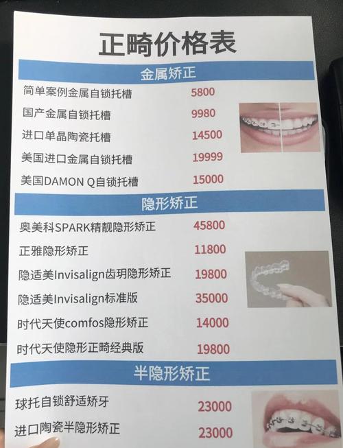 衢州柯城蓝芽口腔诊所牙齿矫正价格_衢州种植牙价格_衢州牙齿矫正费用