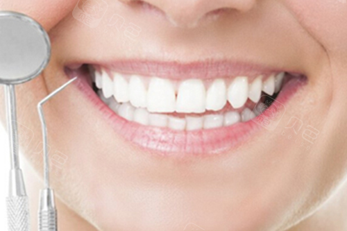 牙齿检查宣传示意图