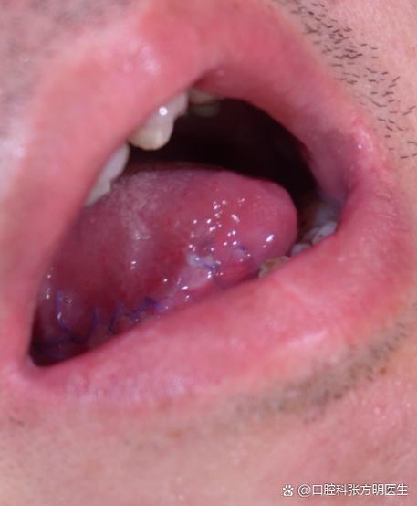 南宁口腔医院排名_南宁梅毒专科医院推荐_南宁治疗梅毒医院排名