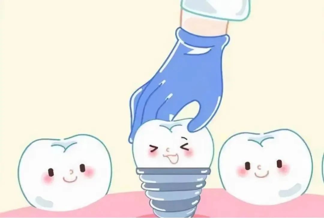 赤峰口腔种植体集采降价900元_遵义铂菲口腔门诊部种植牙价格_四级纯钛种植体系统价格