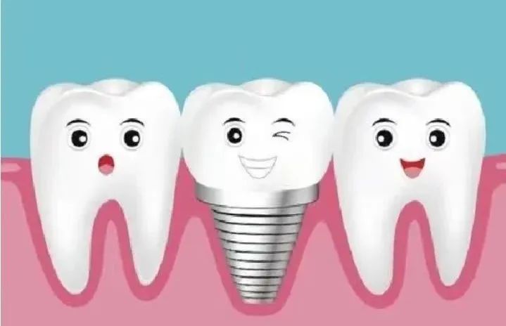 遵义铂菲口腔门诊部种植牙价格_赤峰口腔种植体集采降价900元_四级纯钛种植体系统价格