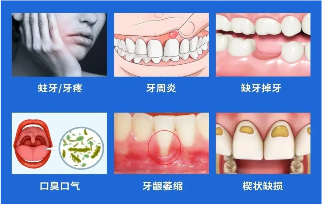 清远非医保口腔项目补贴_清远口腔医院排名_清远口腔补贴计划