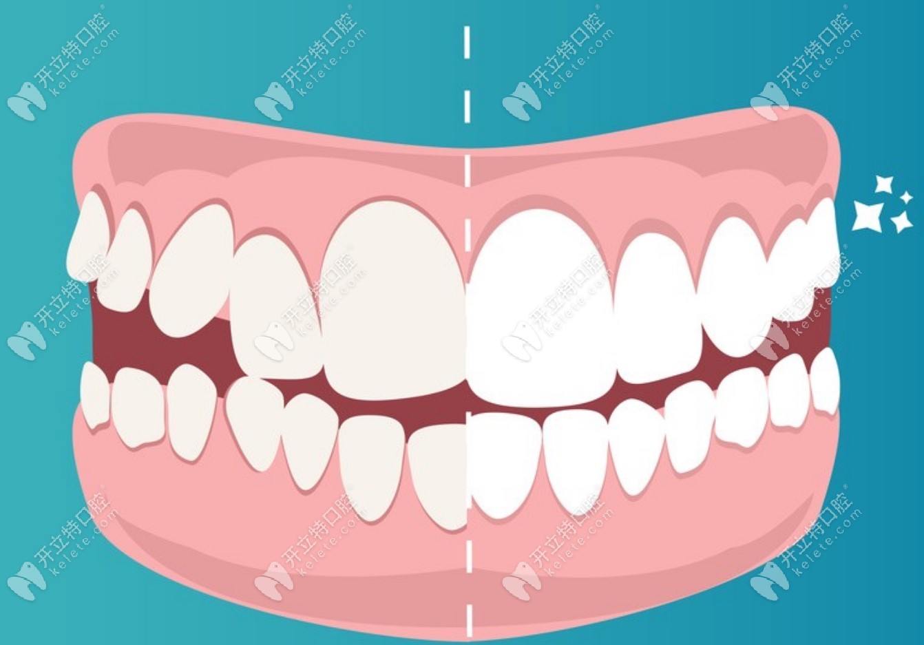 潍坊口腔医院_潍坊坊子韩国启口腔郑梓恒_潍坊登腾种植牙