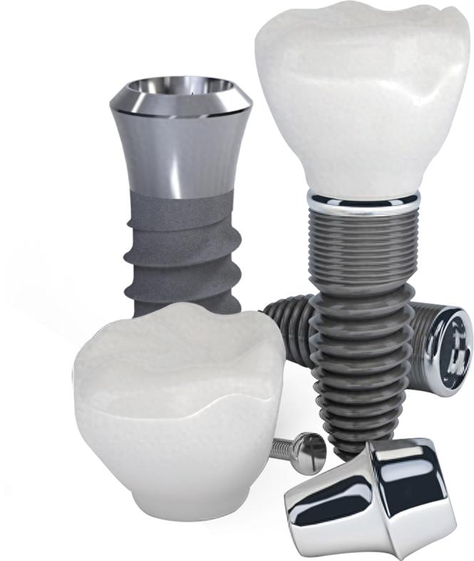 荆州BEGO种植牙费用构成_德国BEGO种植牙荆州价格_奔跑口腔诊所种植牙价格