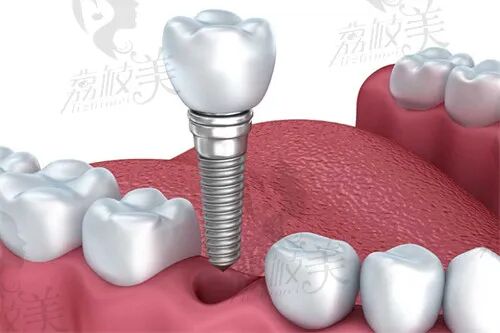 荆州区牙科医院_荆州咿呀雅美口腔沙市门诊部（沙市区总院）怎么样_荆州牙医诊所