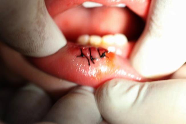 未央品优牙都口腔门诊部总院_西安未央儿童口腔医院_袁林天儿童口腔医院未央分院